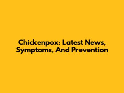 Chickenpox: Latest News, Symptoms, And Prevention