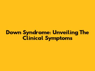 Down Syndrome: Unveiling The Clinical Symptoms