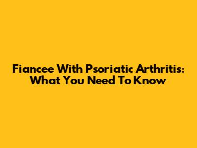 Fiancee With Psoriatic Arthritis: What You Need To Know