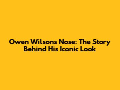 Owen Wilson's Nose: The Story Behind His Iconic Look