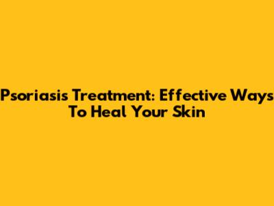 Psoriasis Treatment: Effective Ways To Heal Your Skin